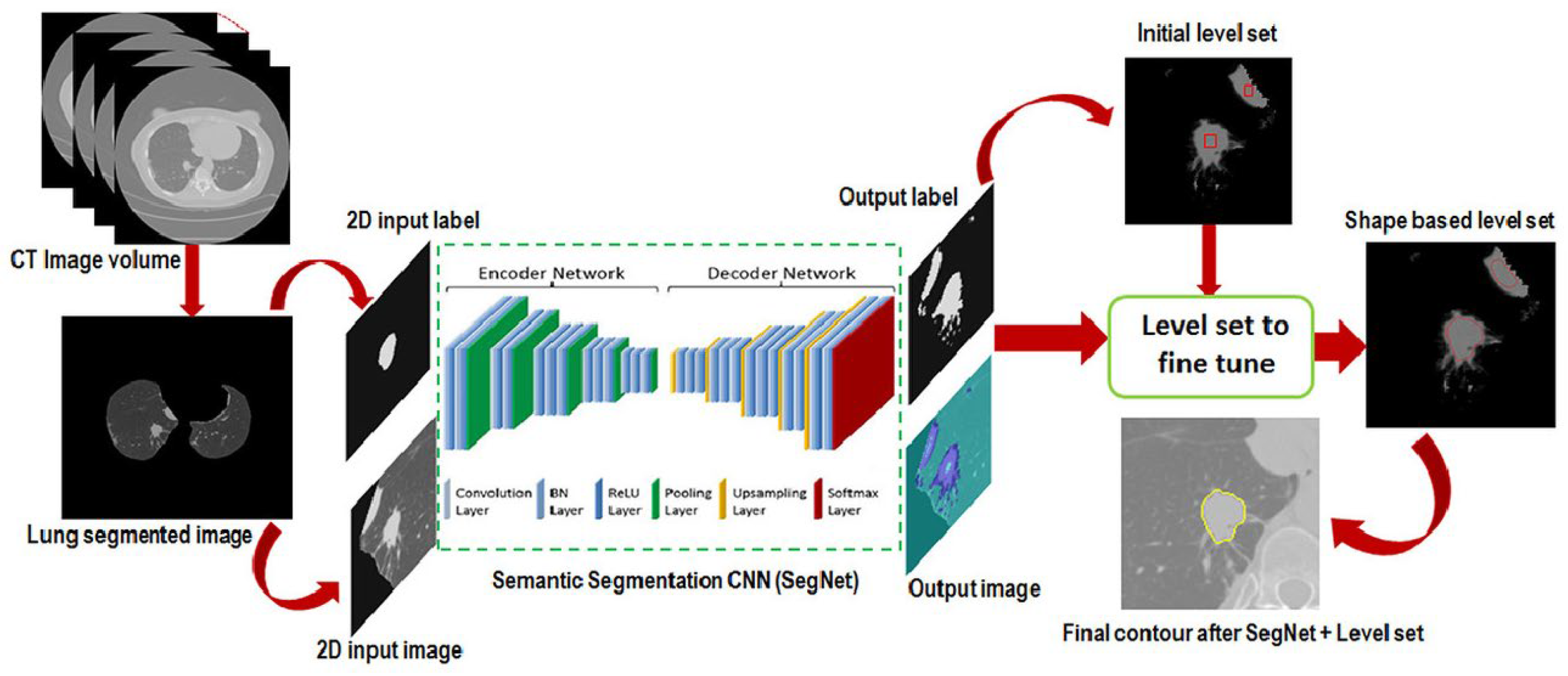 Lung Cancer Detectin Machine Learning